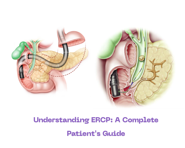 Understanding ERCP: A Complete Patient's Guide